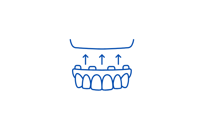 Dentures and Artificial teeth